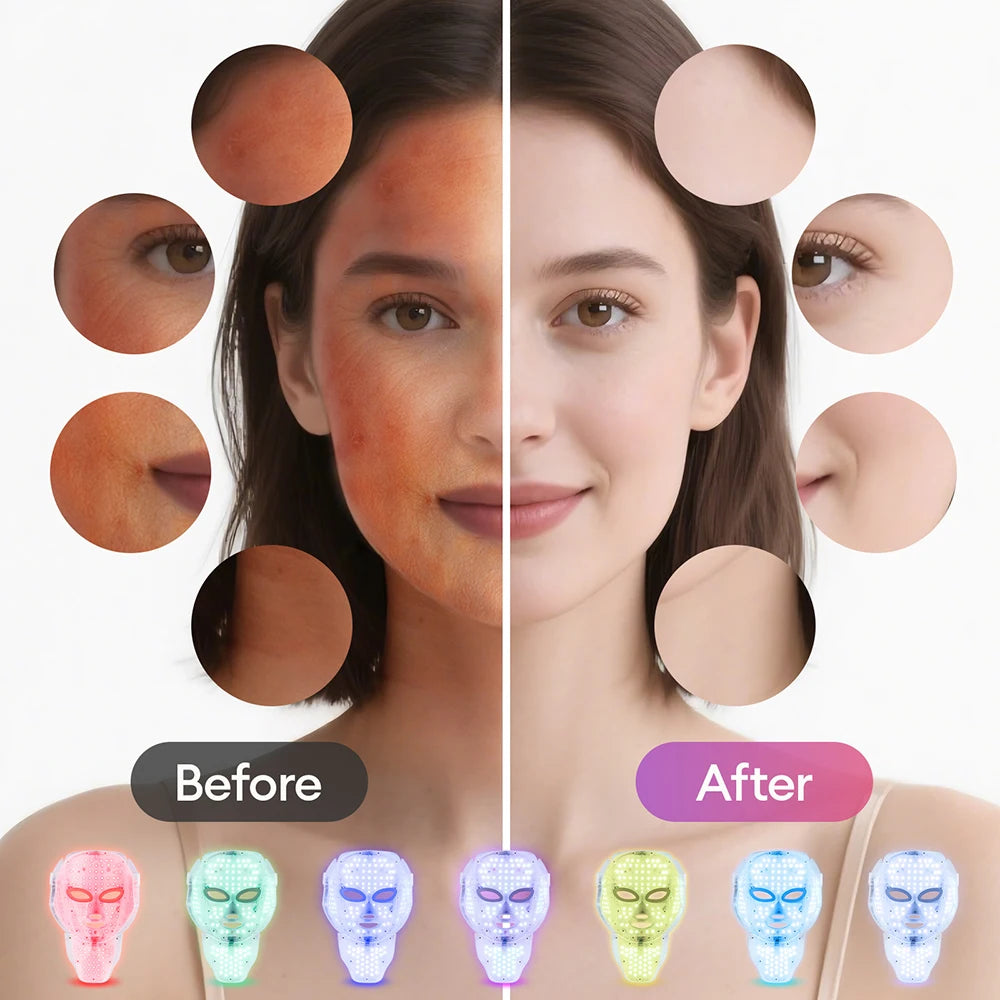 AuraGlow™ LED Therapy Mask